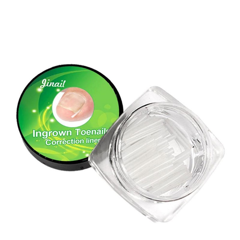 Διορθωτές  Ανύψωσης  Νυχιού Σετ 10 τεμαχίων