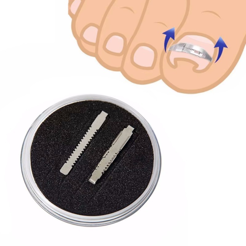 Νάρθηκας Ονυχοκρύπτωσης Μεταλλικός Με Προέκταση